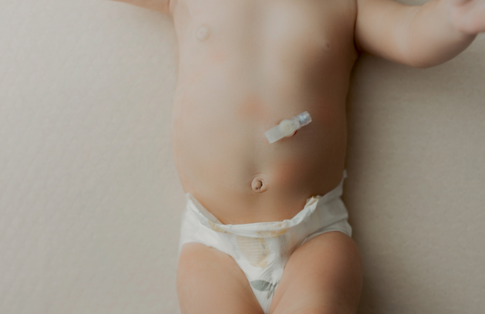 A baby with a gastrostomy tube (G-tube) lying on their back. 